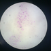 Toxoplasma gondii - Photo (c) Laura Mahecha (SaracuraGcb), todos los derechos reservados, uploaded by Laura Mahecha (SaracuraGcb)