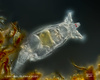 Bdelloidean Rotifers - Photo (c) plingfactory, all rights reserved