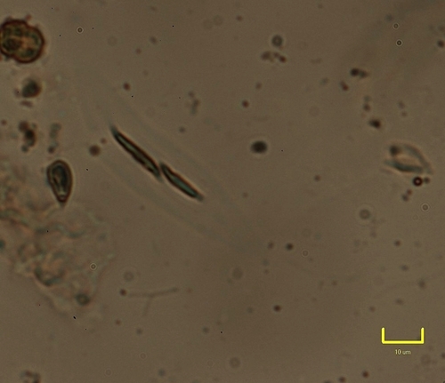 Elakatothrix genevensis