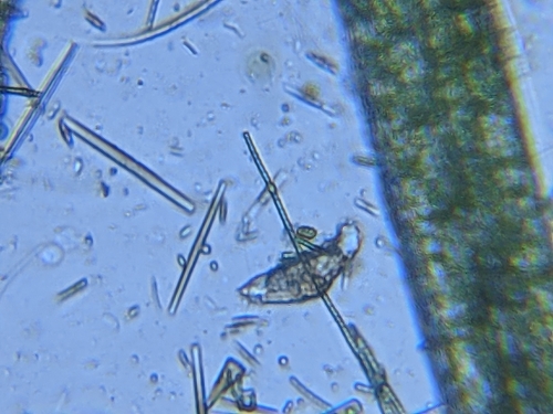 iNaturalist observation photo of Euglena