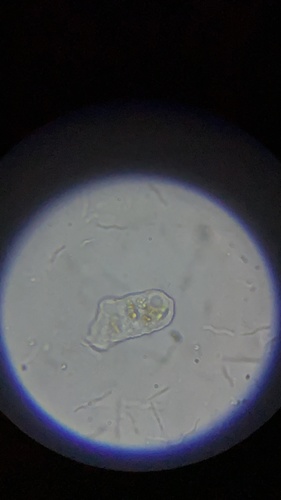 photo of (Amoebozoa)