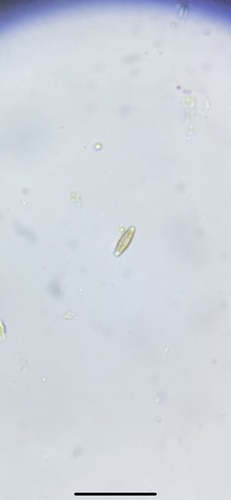 photo of Diatoms (Bacillariophyceae)