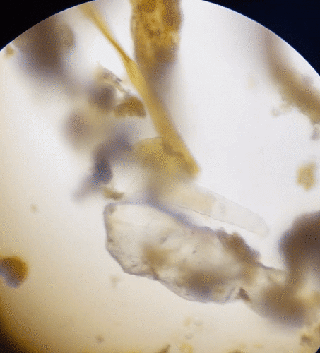 photo of Bdelloidean Rotifers (Bdelloidea)