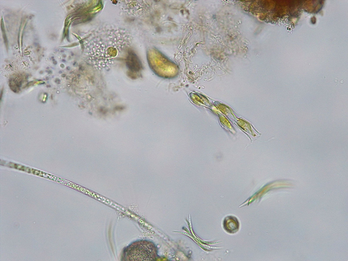 Dinobryon protuberans · iNaturalist