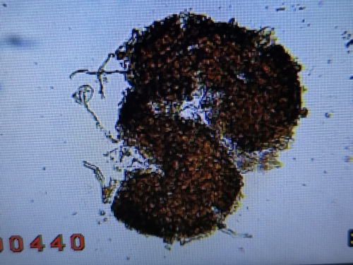Golovinomyces artemisiae