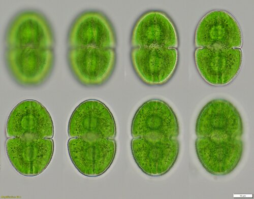 Cosmarium microsphinctum