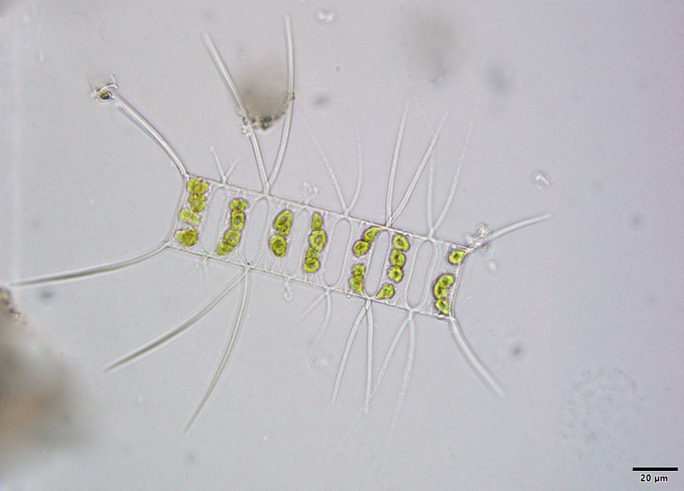 Chaetoceros Marine Phytoplankton Of The Grand Strand Region Of SC chaetoceros-marine-phytoplankton-of-the-grand-strand-region-of-sc