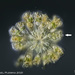 Conochilus hippocrepis - Photo (c) plingfactory, όλα τα δικαιώματα διατηρούνται