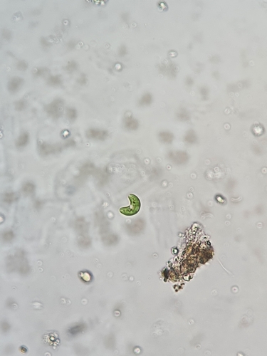 Ankistrodesmus convolutus