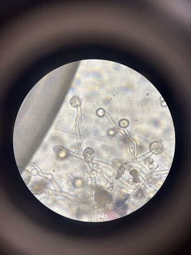Phylum Mucoromycota · iNaturalist