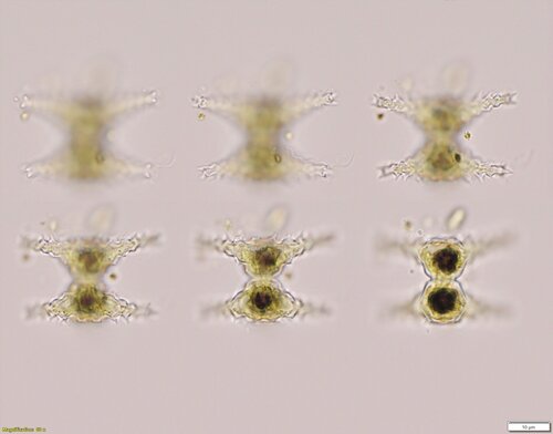 Staurastrum manfeldtii
