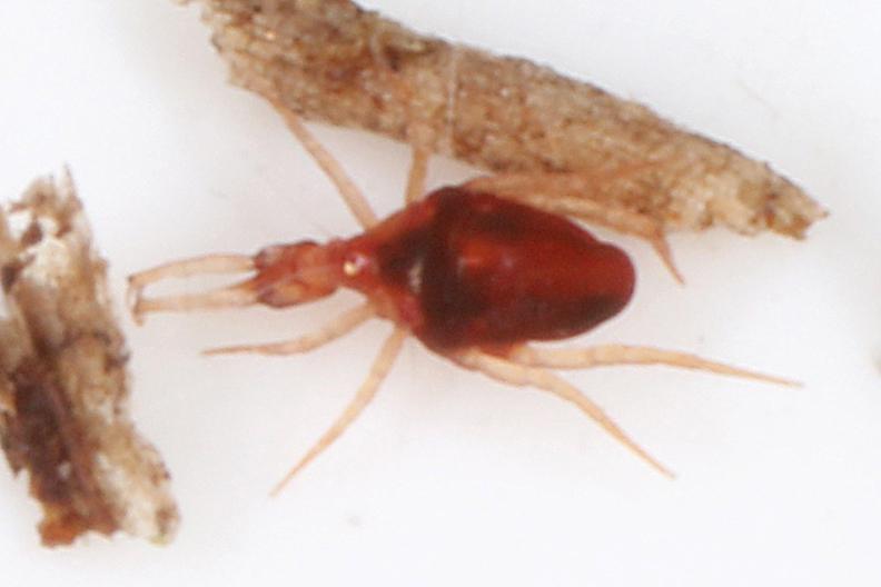 Cunaxidae from PichlKainisch, Österreich on June 21, 2022 at 0908 PM