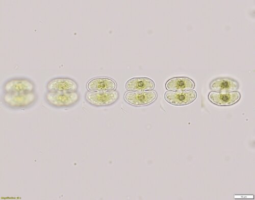 Cosmarium abbreviatum