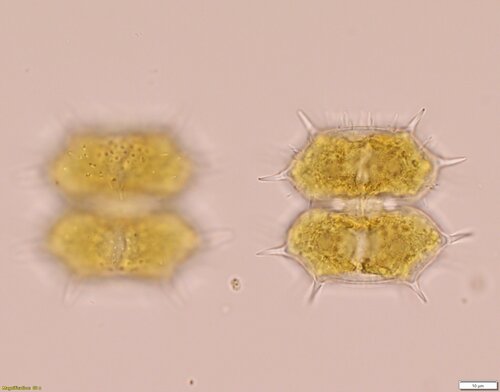 Xanthidium antilopaeum var. antilopaeum