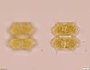 Xanthidium antilopaeum antilopaeum - Photo (c) wleurs, all rights reserved