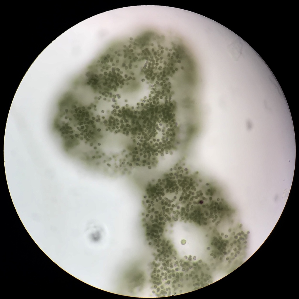 Chroococcales from 93 Paradise Ln, Halifax, MA, US on September 21, 2018 at 1110 AM by