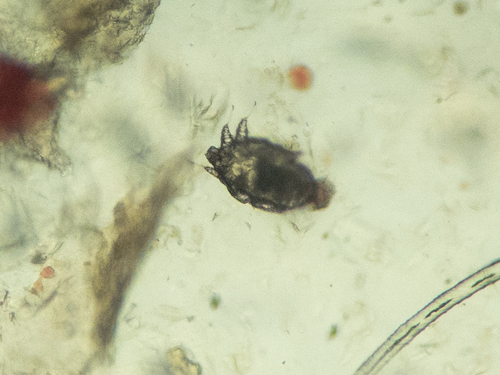Scabies Mite