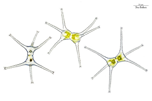 Staurastrum oxyacanthum