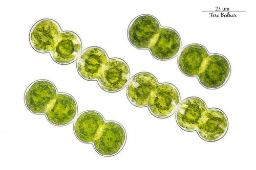 Spondylosium