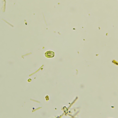 Malaria (Genus Plasmodium) · iNaturalist