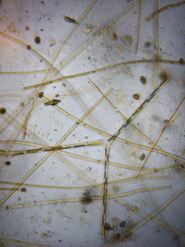 Asterionella formosa from 754 22 Uppsala, Sweden on November 18, 2023 ...