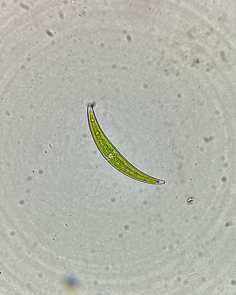 Closterium from สาริกา, อำเภอเมืองนครนายก, จ.นครนายก, TH on December 17 ...