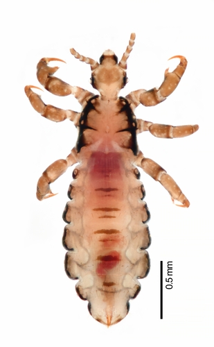 Human Head Louse