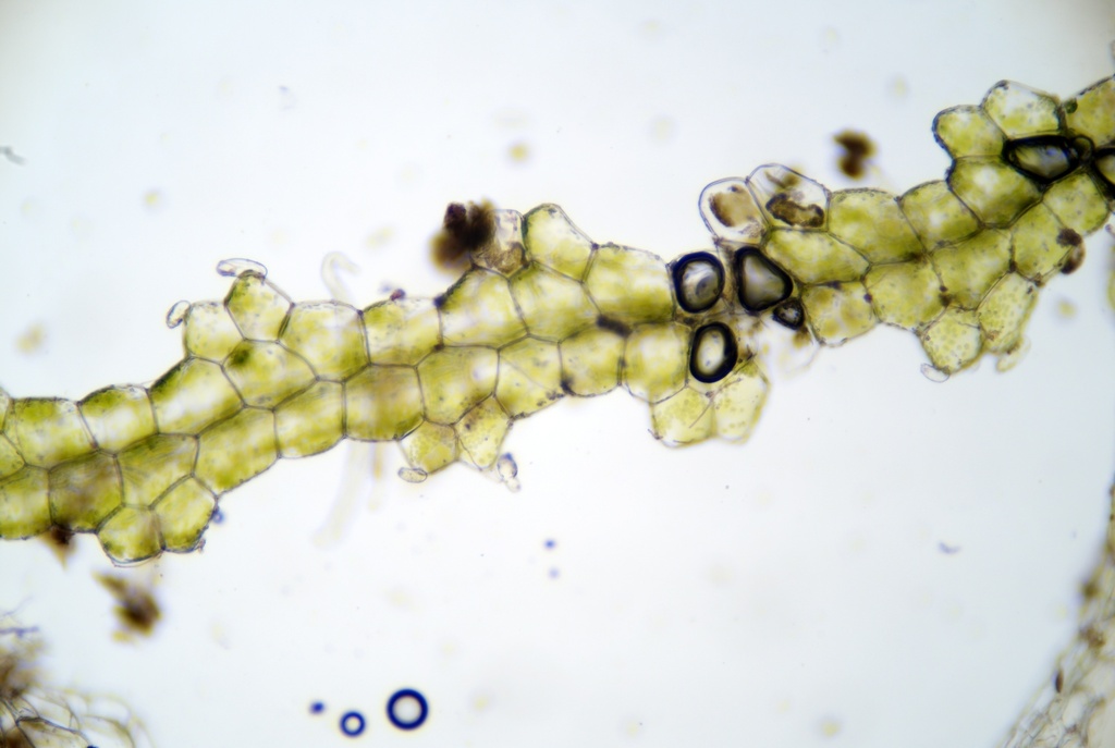 Zoopsis liukiuensis (Zoopsis liukiuensis)
