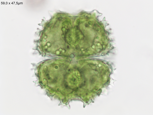 Staurastrum spongiosum