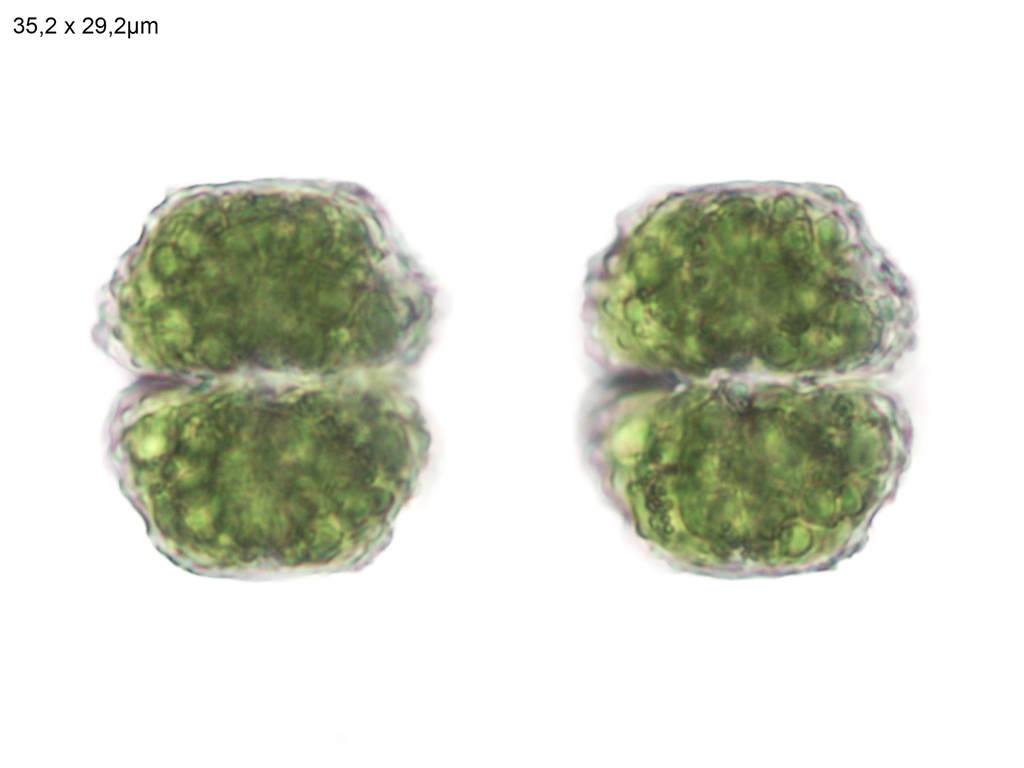 Cosmarium corbula from Wijnjewoude, Nederland on April 3, 2024 at 12:51 ...