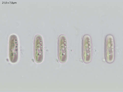 Mesotaenium endlicherianum