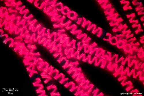 Spirogyra