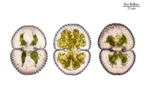 Cosmarium tetraophthalmum