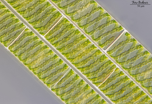 Spirogyra