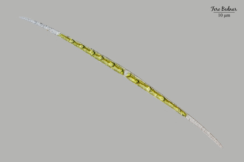 Closterium acutum