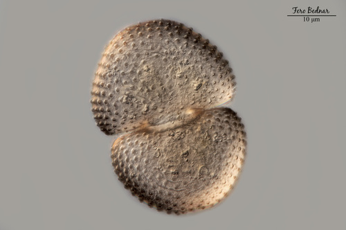 Cosmarium tetraophthalmum