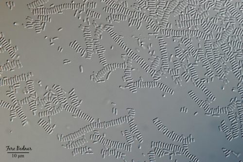 Bacteria