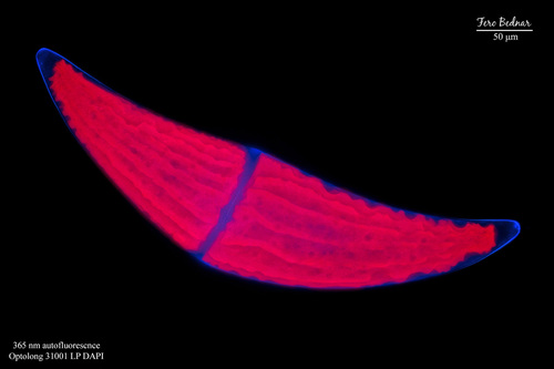 Closterium ehrenbergii