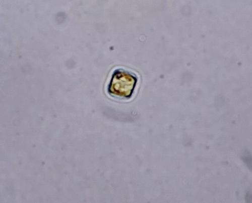 Thalassiosira pseudonana