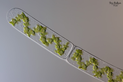 Spirogyra