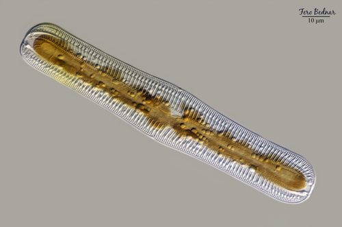 Epithemia gibba