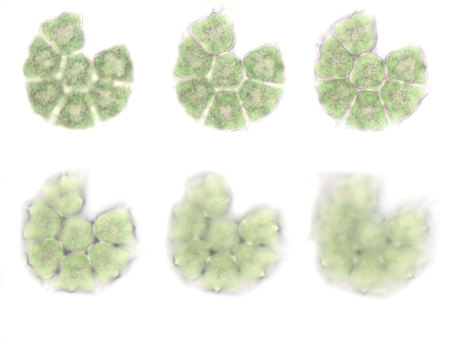 Pediastrum braunii