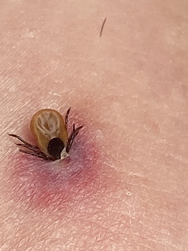 Eastern Black-legged Tick