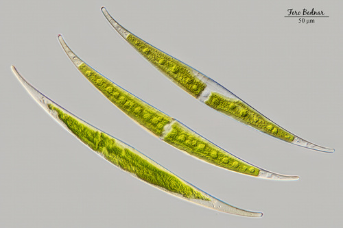 Closterium rostratum