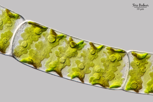 Spirogyra