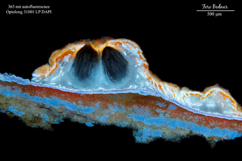 Pertusaria leioplaca