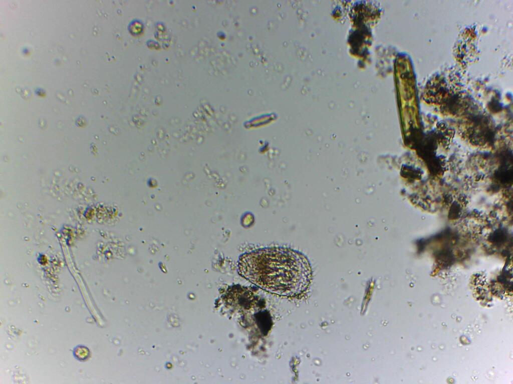 Euglypha from Araras, Petrópolis - RJ, Brasil on March 8, 2026 at 04:44 ...