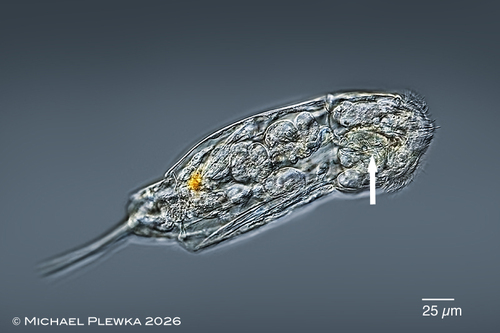 Cephalodella tenuiseta