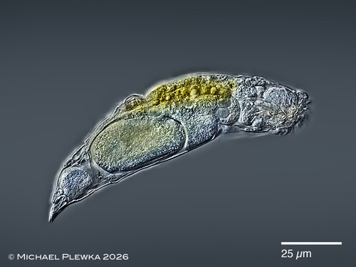 Encentrum spinosum