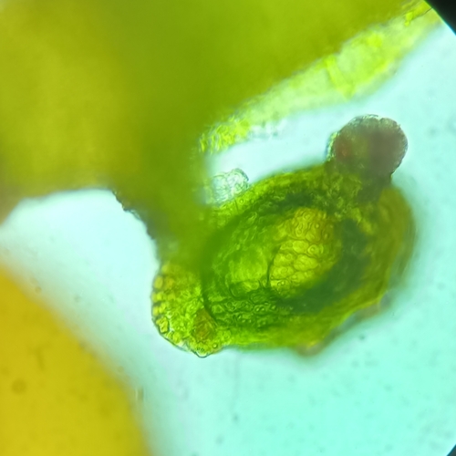 Frullania calcarifera